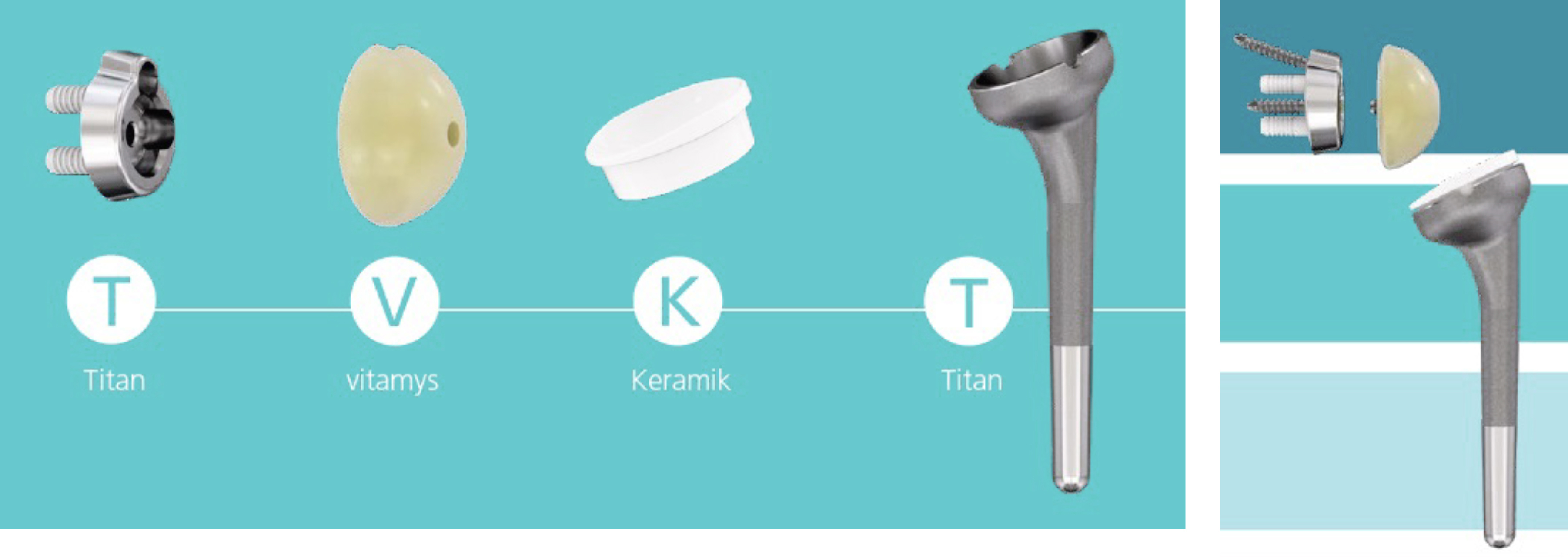 Inversive Schulterprothese